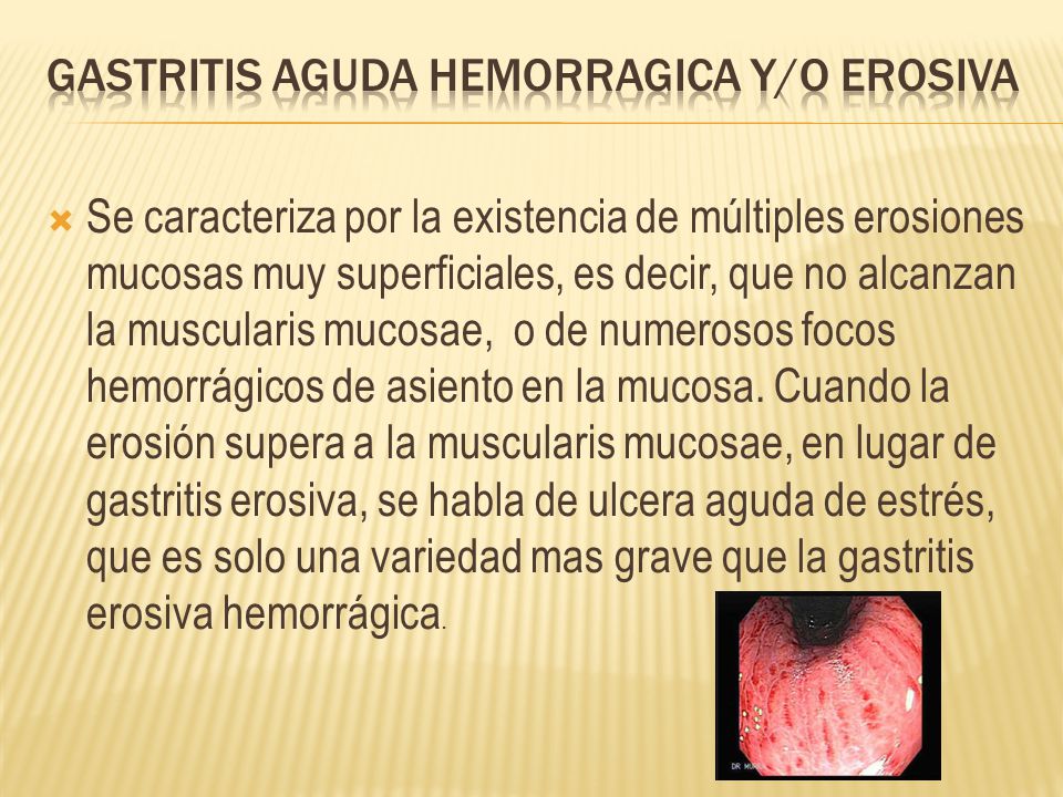 Cuanto dura una gastritis aguda